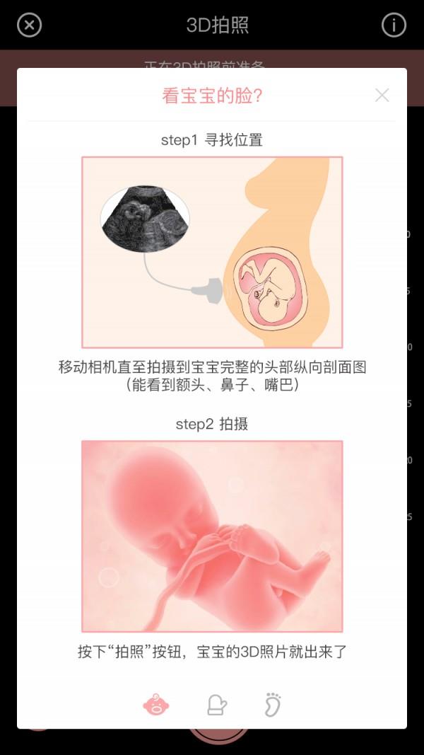 胎儿相机  v1.4.2图1