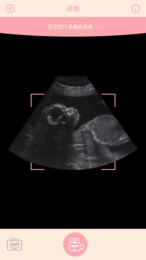 胎儿相机  v1.4.2图4